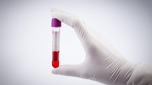 Hati-hati! Golongan Darah Ini Ternyata Lebih Rentan Kena Stroke di Usia Muda